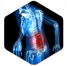 Back pain treatment 