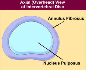 Normal Intervertebral Disc